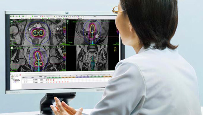 Elekta’s new radiosurgery system receives CE mark